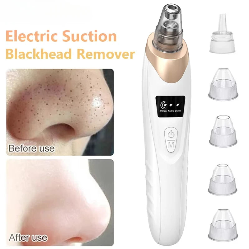 Face Vacuum Suction Blackhead Remover – Electric Pore Cleaner
