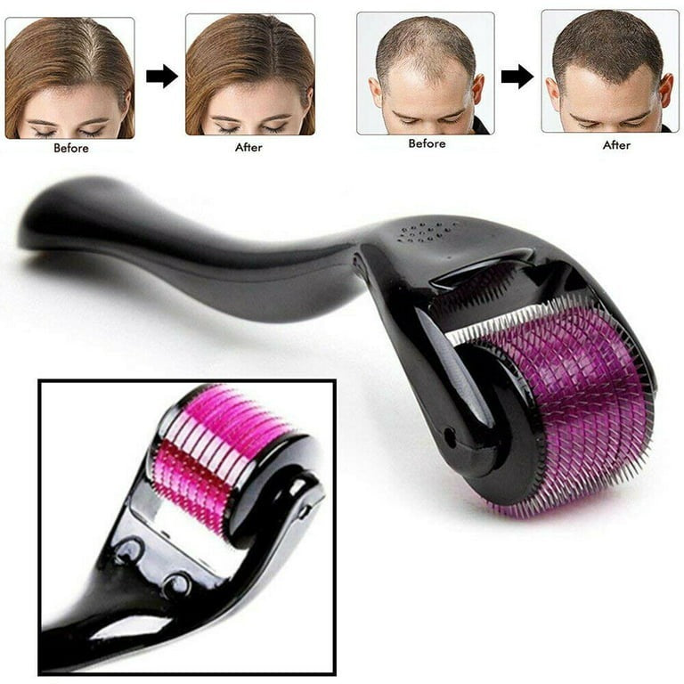 Derma Roller 0.5mm – 540 Micro Needles | Professional Microneedling for Face, Beard & Hair Growth