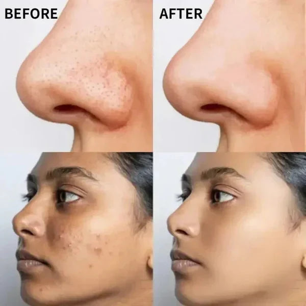 The Ordinary Vitamin C Suspension 30% in Silicone – Brightening Serum for Radiant, Even-Toned Skin (Imported Quality)